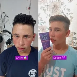 Progressiva homem cabelo curto antes e depois
