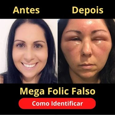 Mega Folic Pirata Não funciona