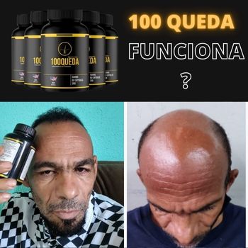 100 Queda funciona - Onde comprar