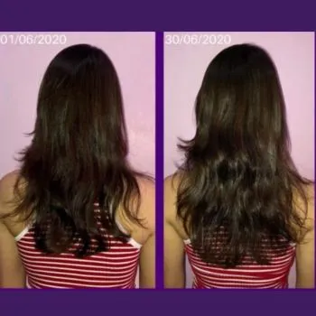 Fortific Hair antes e depois