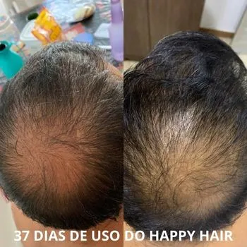 Happy Hair funciona para homem