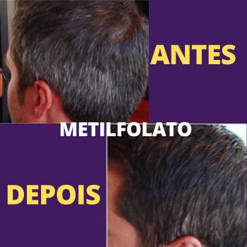 Metilfolato Antes e Depois