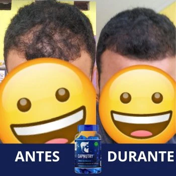 Capnutry Hair antes e depois