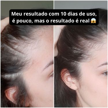 shampoo anti queda para crescimento capilar