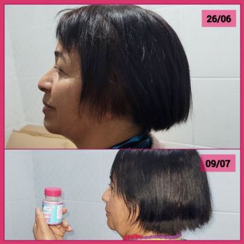 Vitamina Cabelo Fraco