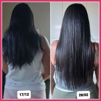 Vitamina Crescer Cabelo Rápido