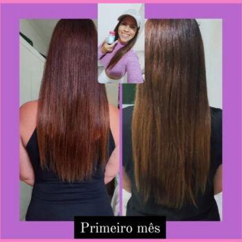 Vitamina Crescimento Cabelo