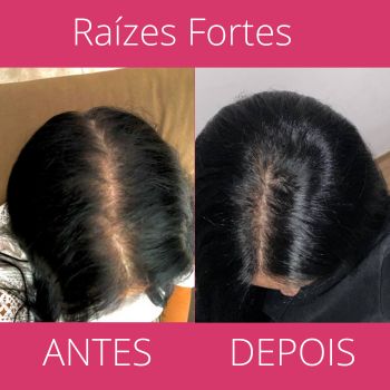 Vitamina para Raíz do Cabelo